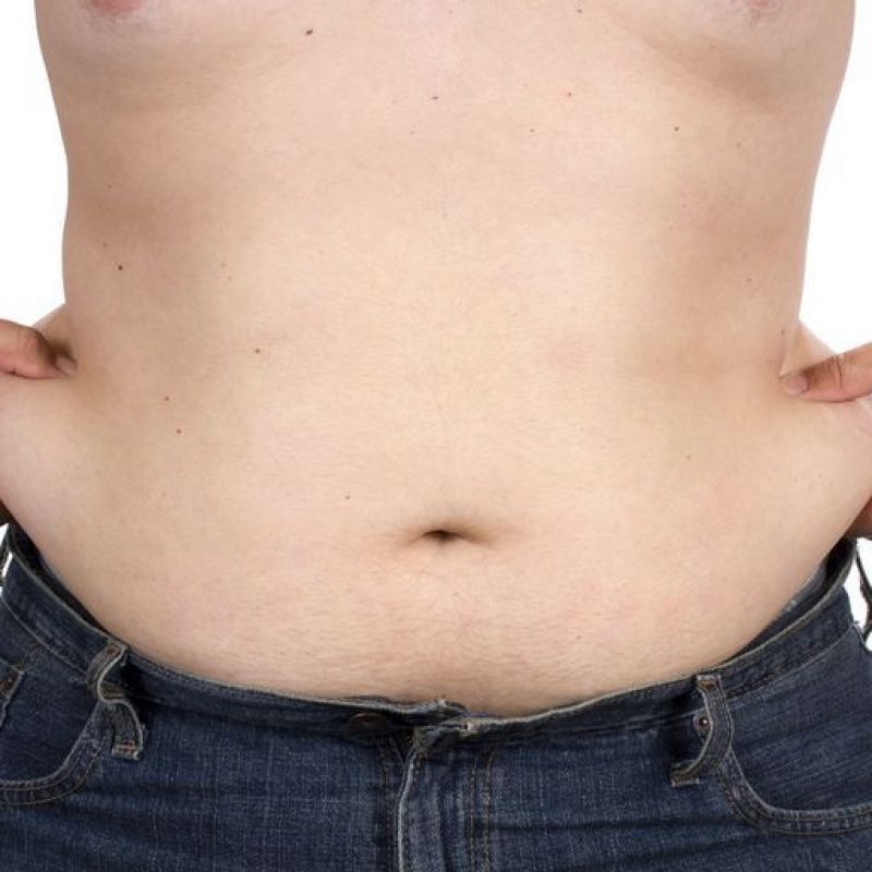 liposuction-for-men